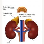 Tổng quan Tăng Sản Thượng Thận Bẩm Sinh