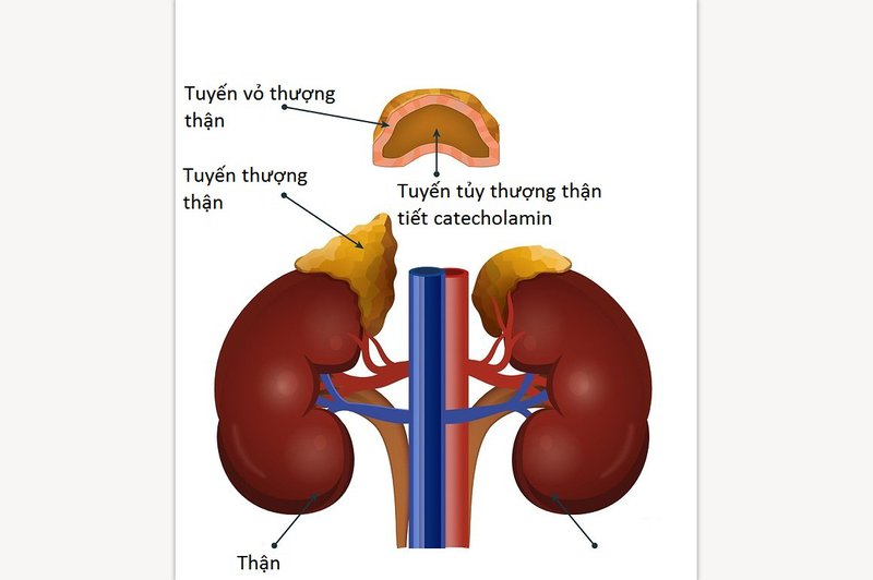 Hiểu Rõ Hơn Về Bệnh Suy Vỏ Tuyến Thượng Thận