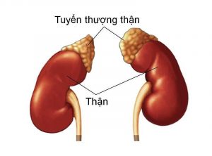 Tăng Sản Thượng Thận Bẩm Sinh Của Trẻ Sơ Sinh