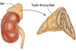 Bệnh Án Suy Thượng Thận