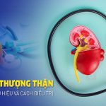 Uống Thuốc Giảm Đau Hư Thượng Thận