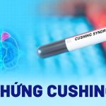 Trục Hạ Đồi Tuyến Yên Thượng Thận