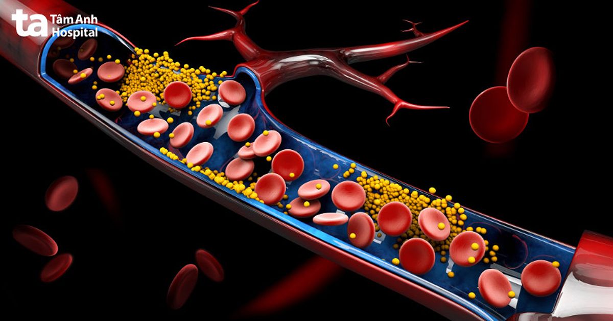 Cholesterol được tổng hợp chủ yếu từ gan và một phần nhỏ qua chế độ ăn uống