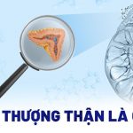 Chi Phí Mổ Nội Soi U Tuyến Thượng Thận