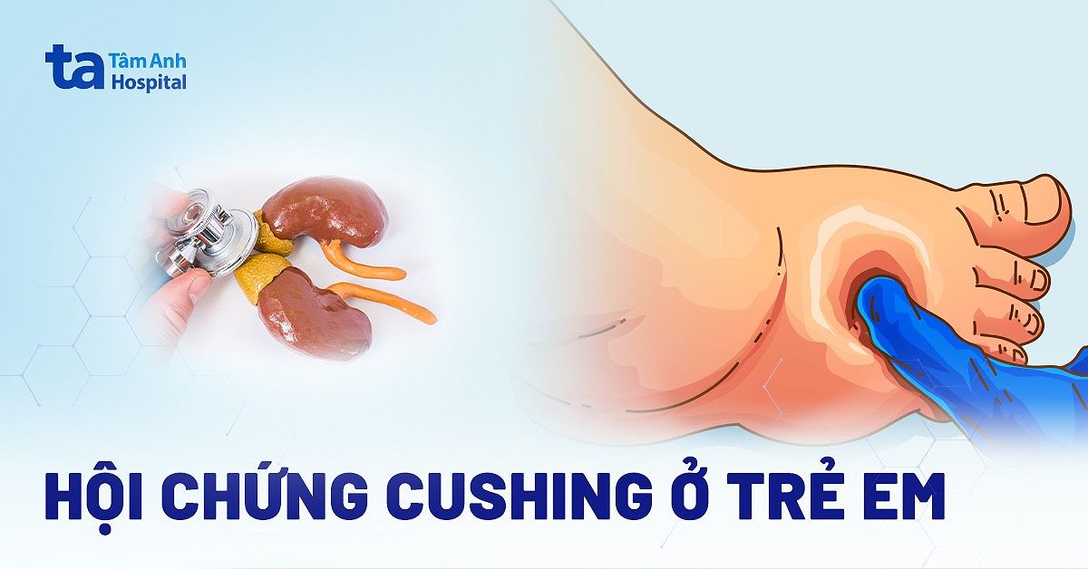 Hội chứng Cushing ở trẻ em