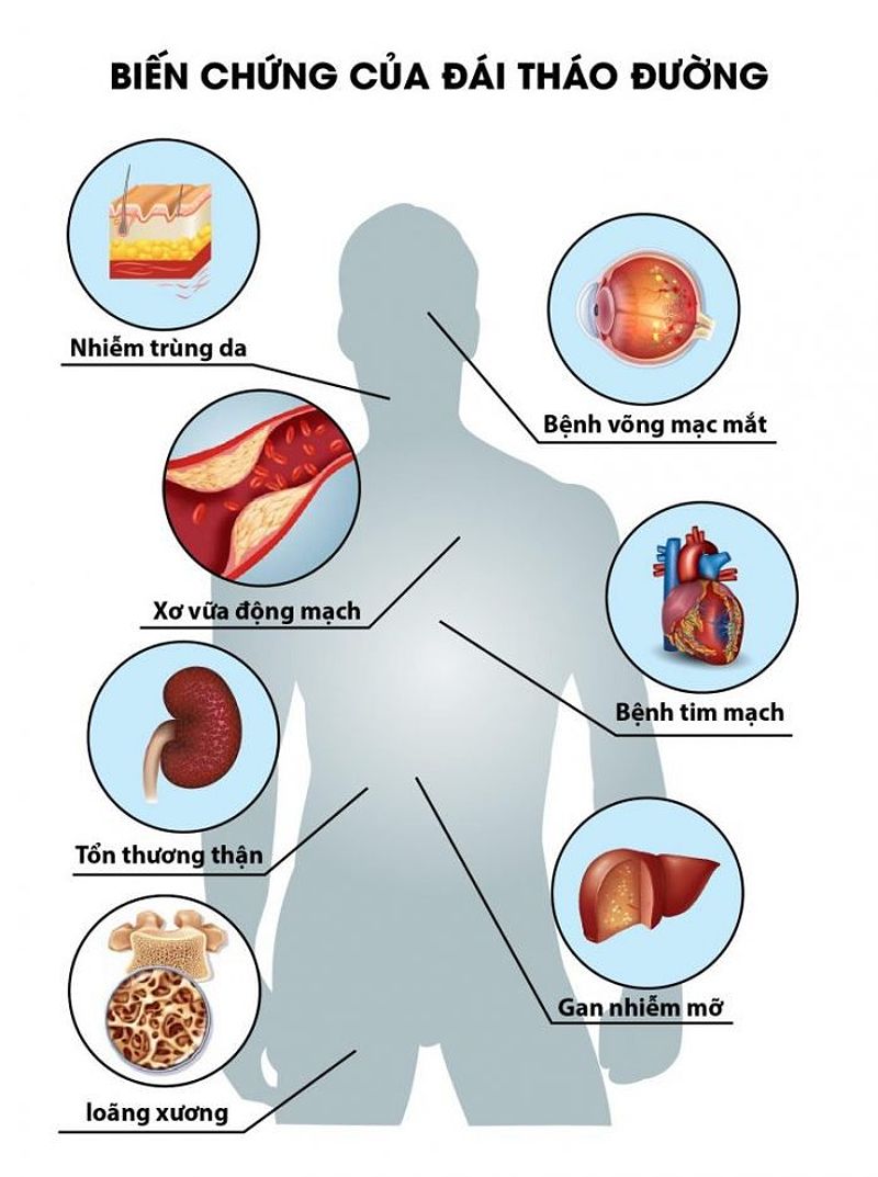 Mối liên hệ giữa tiểu đường và suy thận