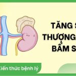 Bệnh Tăng Sản Thượng Thận Bẩm Sinh Có Chữa Được Không?