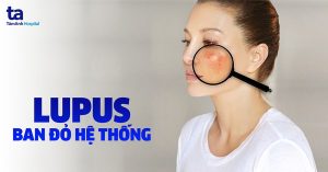 Quỹ Hỗ Trợ Người Bị Lupus Ban Đỏ Thượng Thận