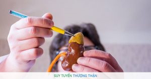 Uống Thuốc Giảm Đau Hư Thượng Thận