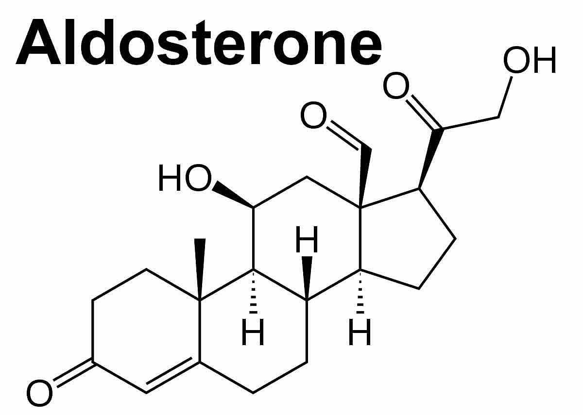 Pheochromocytoma