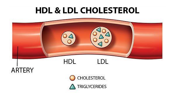 Tai-sao-tang-cholesterol-trong-hoi-chung-than-hu-1