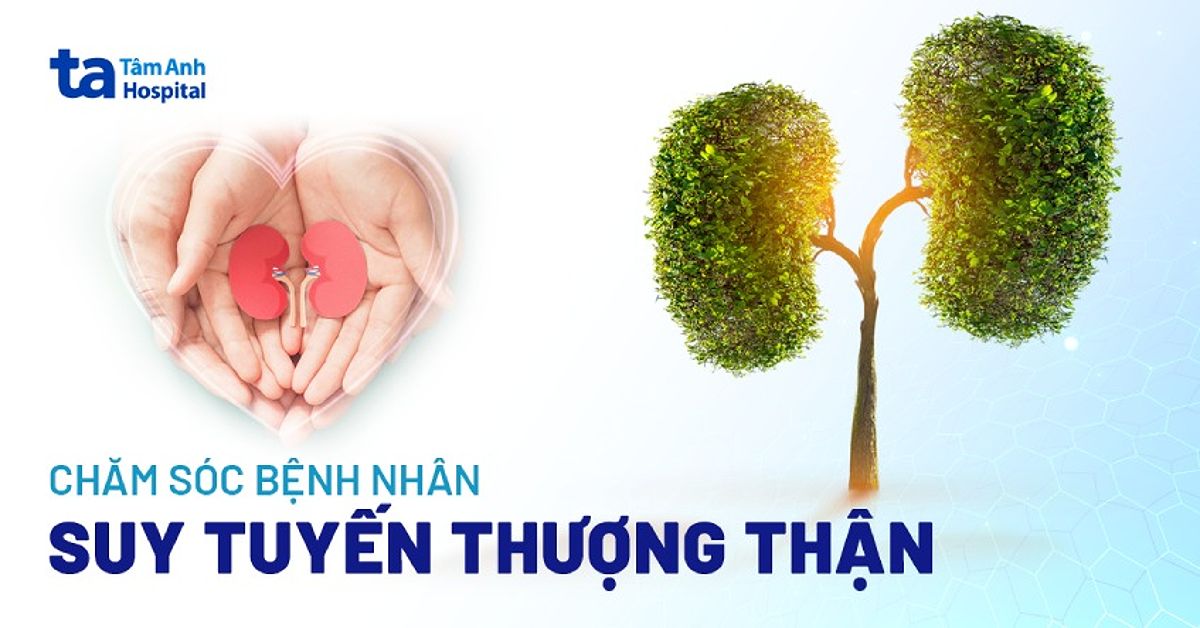 Tập luyện nhẹ nhàng