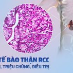 ACTH Kích Thích Thượng Thận