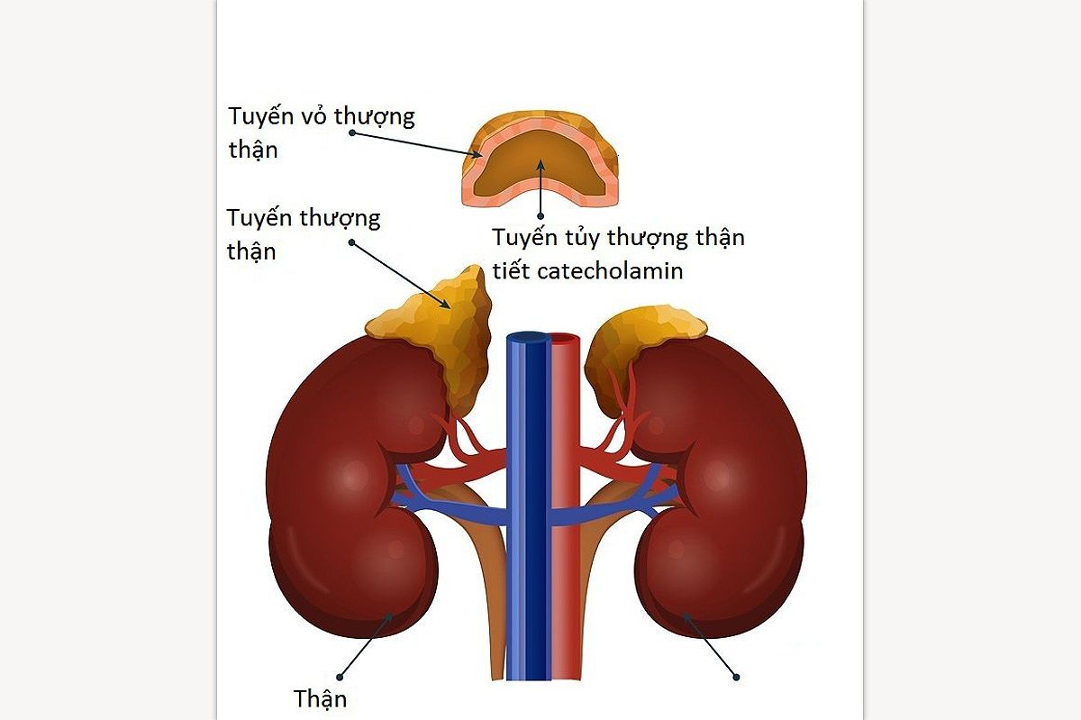 U tuỷ thượng thận