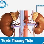 Khát nước do suy tuyến thượng thận