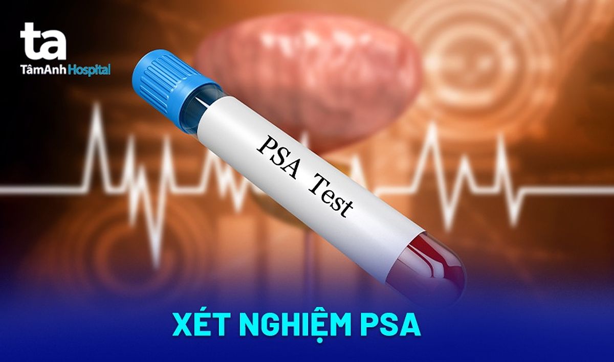 Xét nghiệm PSA